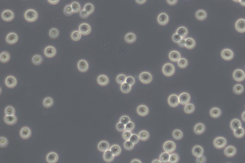 Bakkergist (Saccharomyces cerevisiae) onder de microscoop