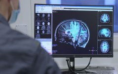 Beeld MRI hersenactiviteit.jpg